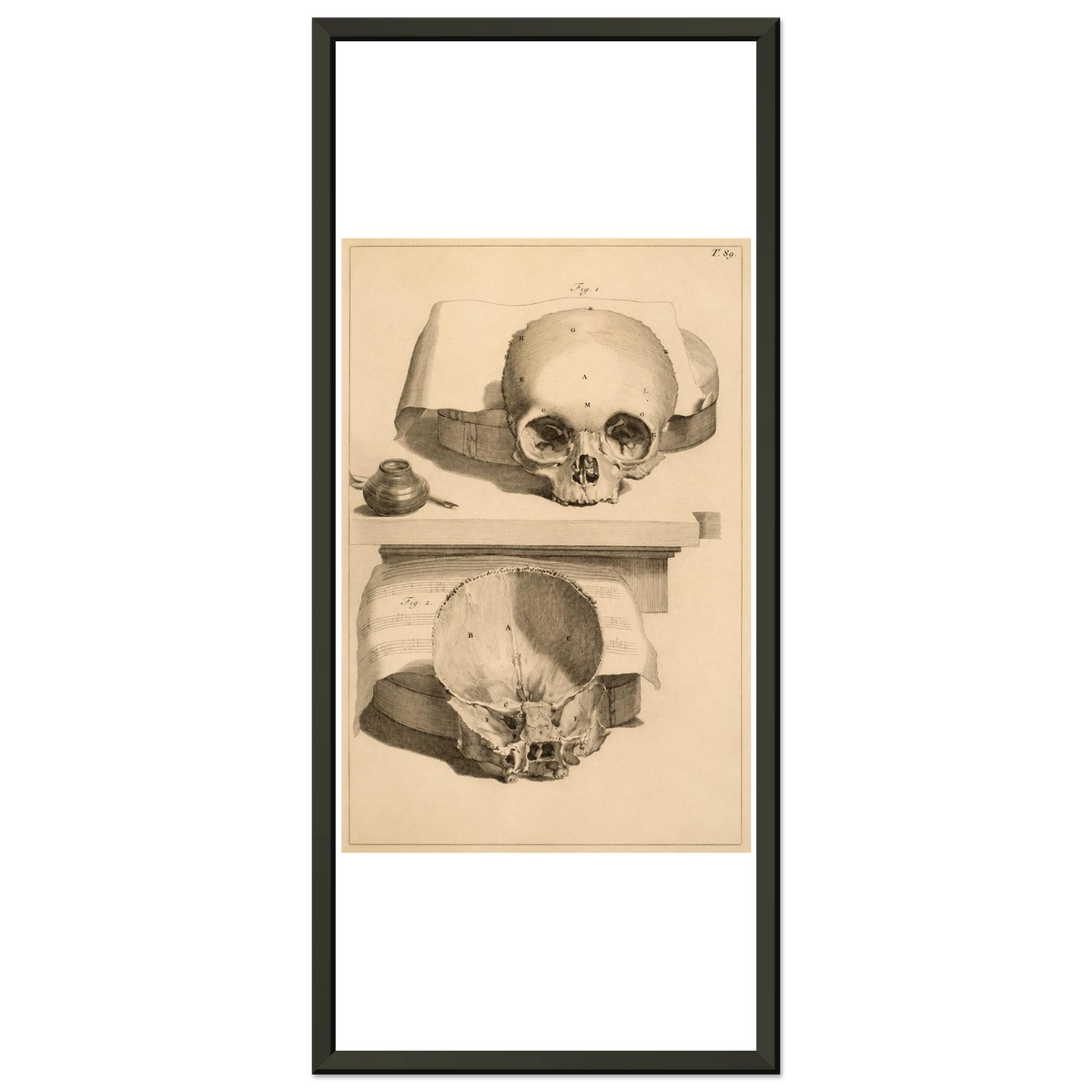 abbd64d0-f415-484c-b646-9fbf6e285e6d